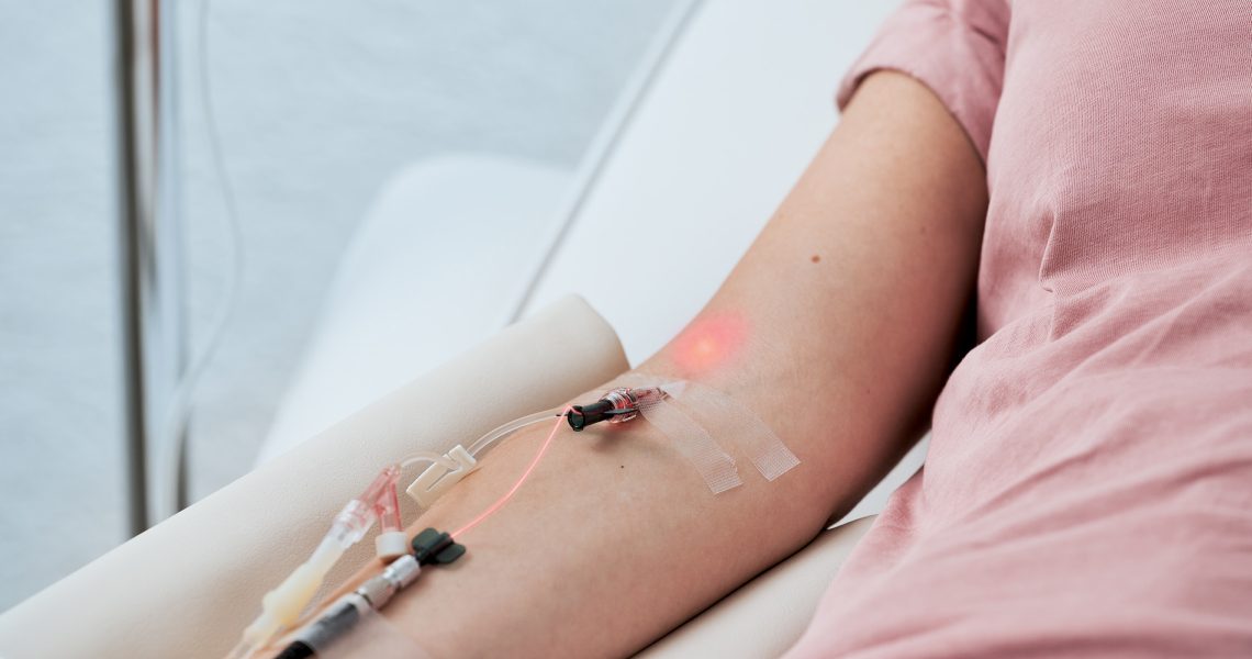 The photo shows photodynamic laser therapy